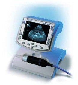 Esaote Tringa 50S Ultrasound