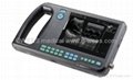 Digital PalmSmart Ultrasound Scanner--GWEES 1