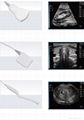 Ultrasound Probe For Obstetrics 1