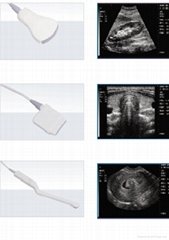 Ultrasound Probe For Obstetrics