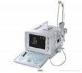 CE approval Ultrasound Scanner S880 1