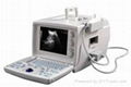 Portable Digital Ultrasound Scanner S660 1