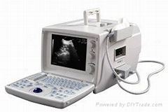 Portable Digital Ultrasound Scanner S660