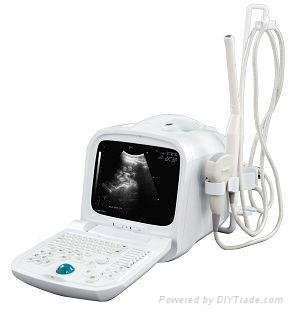 portable Ultrasound Scanner S990