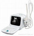 portable Ultrasound Scanner S990 1