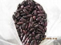 dark red kidney beans 5