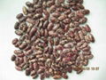 purple speckled kidney beans 2