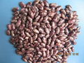 purple speckled kidney beans 4