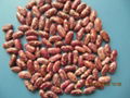 red speckled kidney beans 1