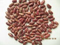 red speckled kidney beans 2