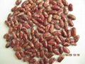 red speckled kidney beans 3