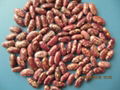 red speckled kidney beans 4