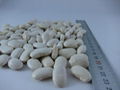 medium white kidney beans