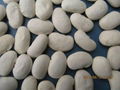 large white kidney beans 1