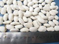 large white kidney beans 2
