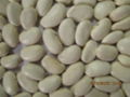 large white kidney beans 4