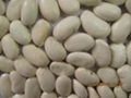 large white kidney beans 5