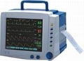 ECG monitor G3C