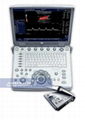 Logiq E Portable Ultrasound Machine