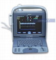 Portable Ultrasound Machine Ver 20 1