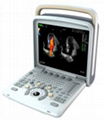 Chison Q8 Color Doppler Ultrasound