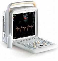 Chison Q6 Color Doppler Ultrasound