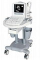 Chison 8300 Ultrasound 1