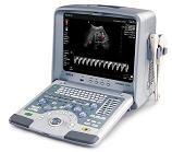 SIUI Apogee 1100 Ultrasound