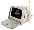 SIUI CTS-5500 Ultrasound 1