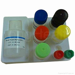 HIV Elisa Kit 