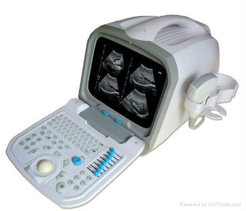 （US400)Portable Digital Ultrasound Scanner