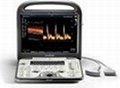 Sonoscape S6 Ultrasound