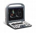 Sonoscape S8 Ultrasound