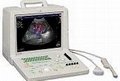 Sonoscape SSI-1000 Portable Ultrasound
