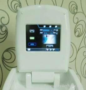 Diode Laser hair removal 808nm 4