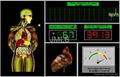 Mini Quantum magnetic resonance Analyzer 3