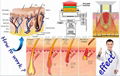 立式双枪激光E光脱毛机 5