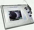 Sonomed Digital EZ B-5500+ B-Scan