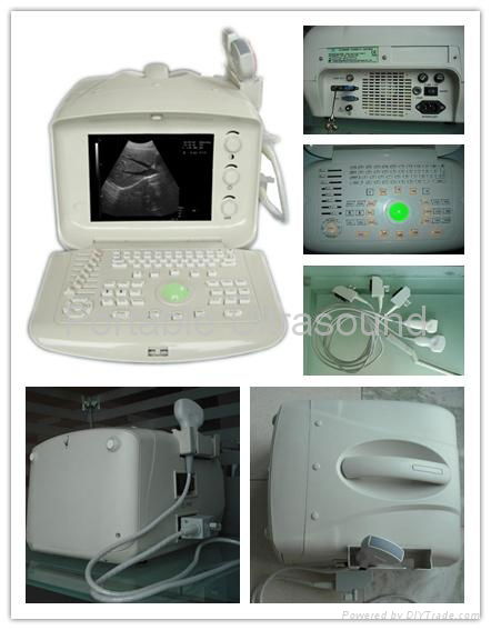 Digital Portable Ultrasound Scanner 3