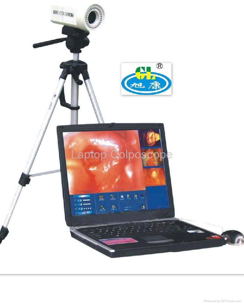 Laptop Digital Electronic Colposcope Machine