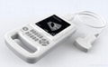 Full-digital Palm Ultrasound Scanner 1