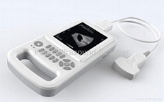 Full-digital Palm Ultrasound Scanner