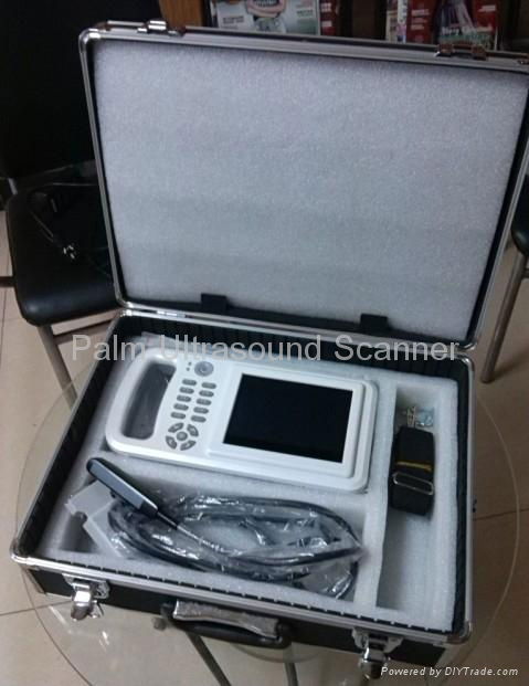 Full-digital Palm Ultrasound Scanner 2