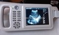 Full-digital Palm Ultrasound Scanner 3