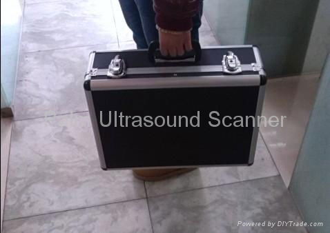 Full-digital Palm Ultrasound Scanner 4