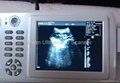 Full-digital Palm Ultrasound Scanner 5