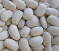 Large White Kidney Beans