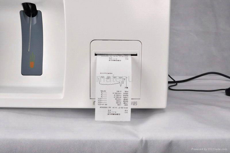 Auto Hematology Analyzer 3