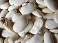 White Kidney Bean P.E 2