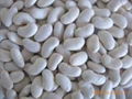 White Kidney Bean P.E 4